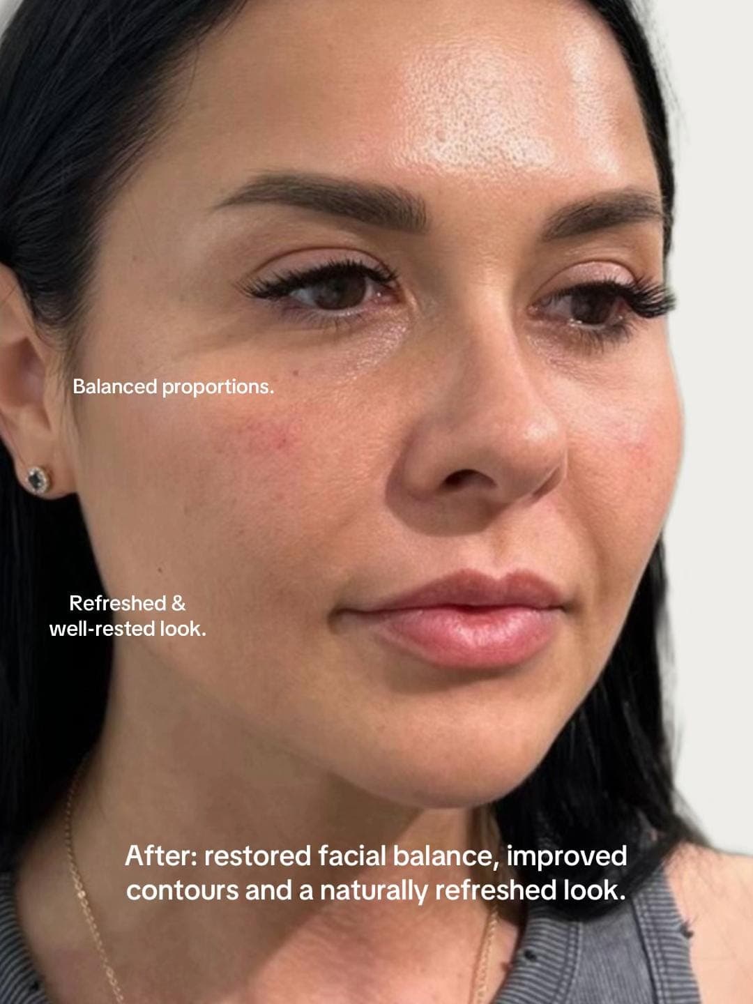 Full face, after, patient of Dr Kate